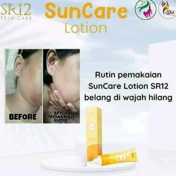 Sale Sun Block Anak/Sun Care Lotion Anak/Sun Block Pemutih Wajah Belang - Paling Diminati
