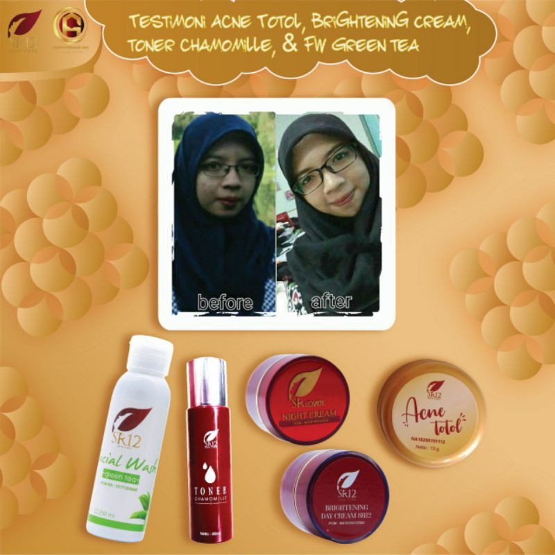 FACIAL WASH GREENTEA SR12 ORIGINAL / SABUN KULIT WAJAH BERMINYAK BPOM / MENGATASI JERAWAT / MELEMBABKAN WAJAH / saudagarsr12