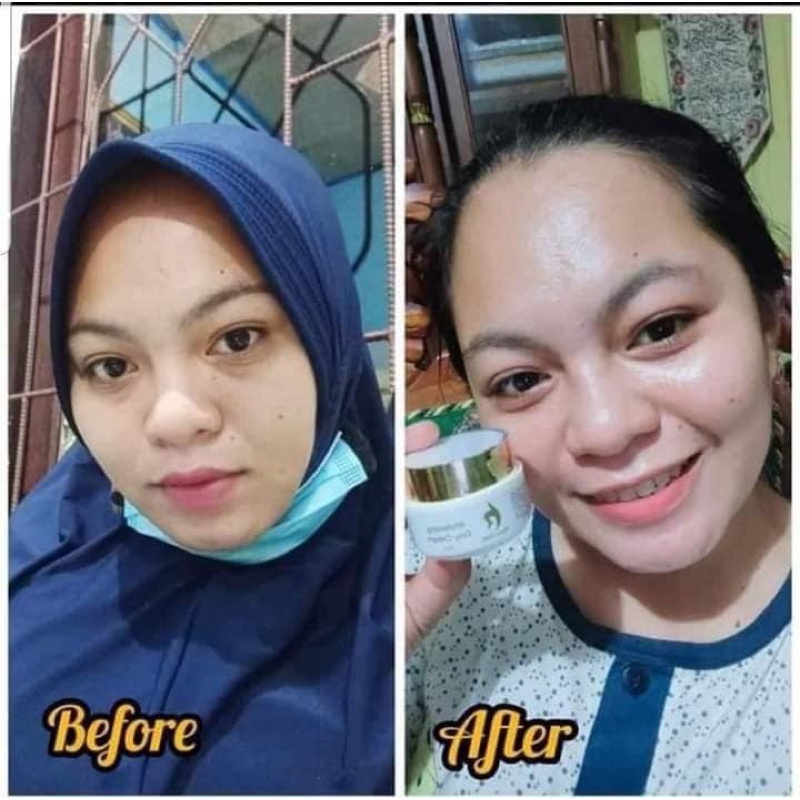 RATU GLOW SKINCARE PAKET BRIGHTENING &amp; ACNE ORIGINAL PENCERAH WAJAH RATU GLOW REGULER RATU GLOW EKONOMIS