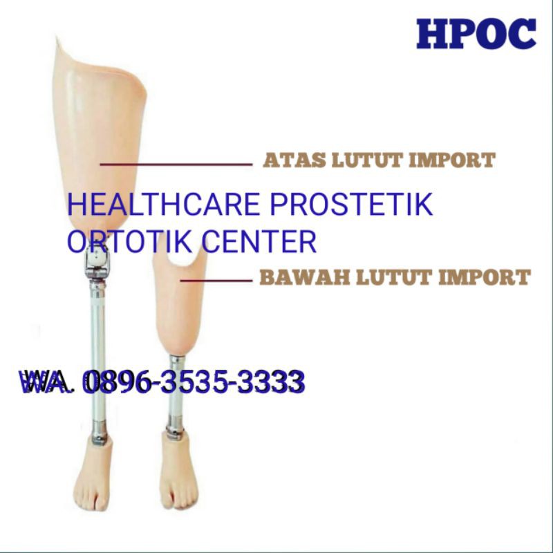 Kaki Palsu Bawah Lutut