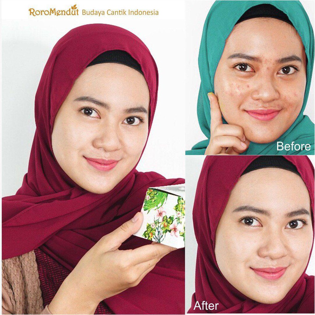 Roro Mendut Green Jelly Sleeping Mask Whitening + Anti Acne Jerawat 15 gr Super Glowing Premium
