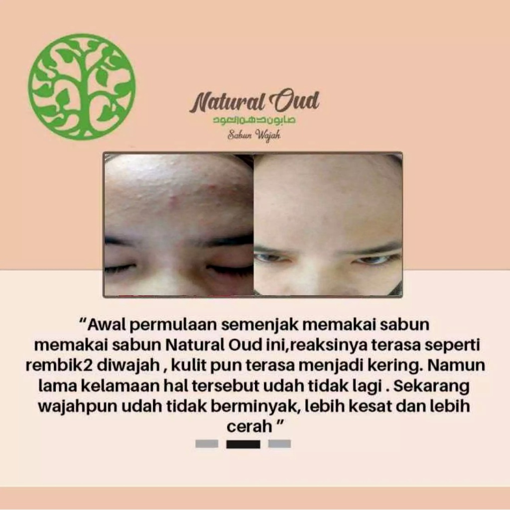 Natural Oud Sabun Cuci Muka Pemutih Wajah Glowing Pembersih Jerawat Kulit Wajah Jadi Cerah dan Sehat BPOM 100% Original Glowup Dari Sekarang