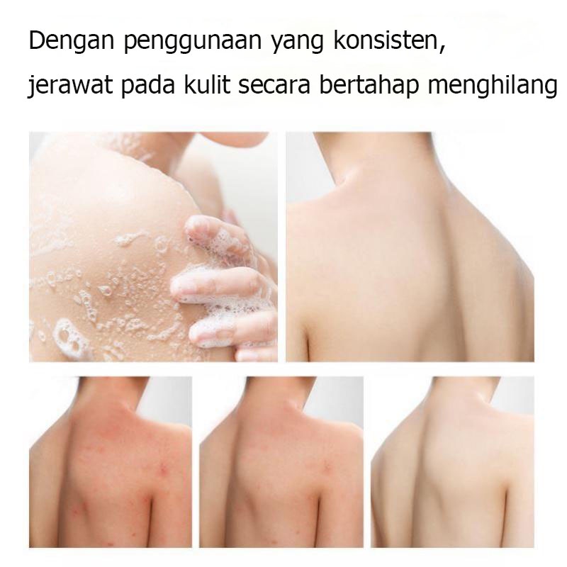 Sabun Mandi Cair Anti-Tungau  Melembabkan Kulit  Body Wash 260g Membersihkan Pori-Pori Dan Kotoran  Mengcagah Munculnya Jerawat  Efek Pelembab Yg Jelas