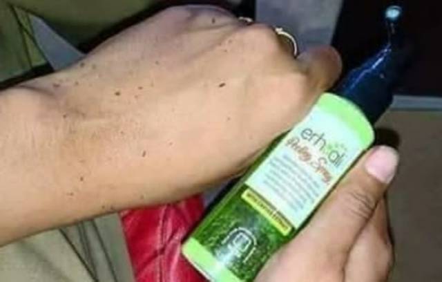 Peeling Spray(Perontok daki/sel kulit mati)