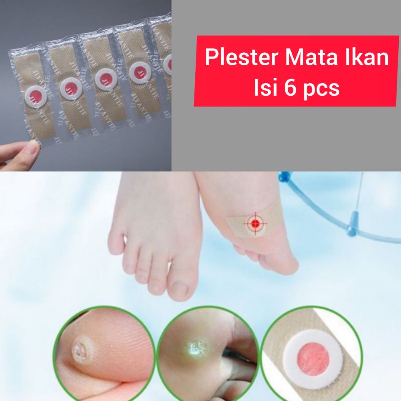 PLESTER MATA IKAN ISI 6 BIJI/STRIP