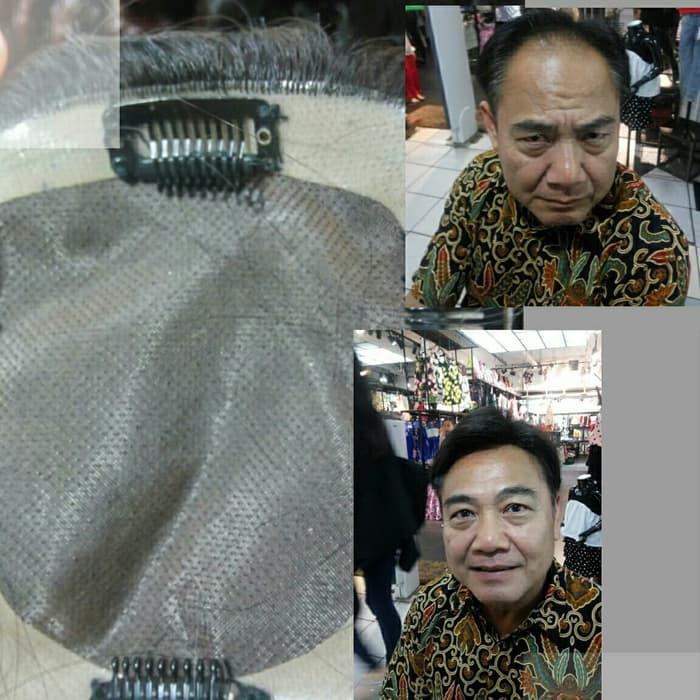 [Rambut] wig khusus untuk kebotakan