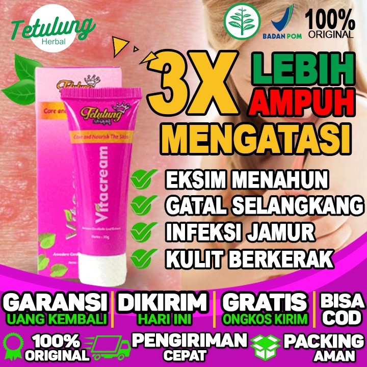 Obat Salep Bisul  Obat Salep Bisul Hitam  Salep Bisul Anak  Salep Bisul Agar Cepat Kering infeksi me