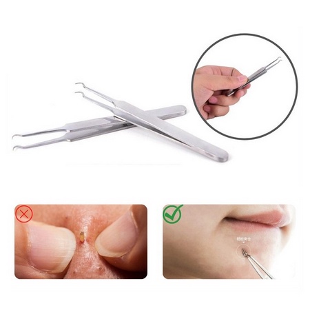Pinset Komedo / Pinset Jerawat / Jepitan Komedo / Blackhead Tweezer (STAINLESS STEEL)