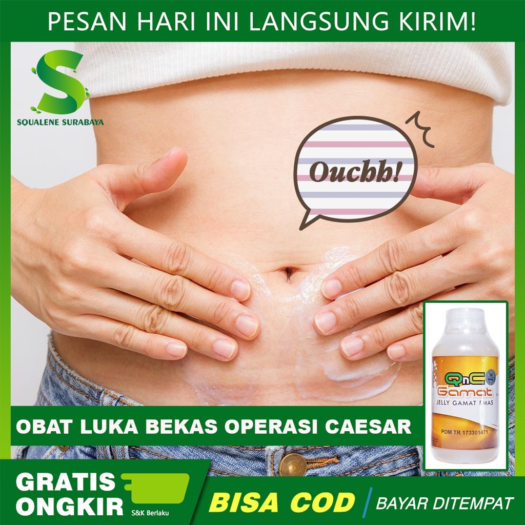 Obat luka Bekas Operasi Caesar & Operasi Bedah - Obat Pengering Luka Bekas Operasi - Penghilang Nyer