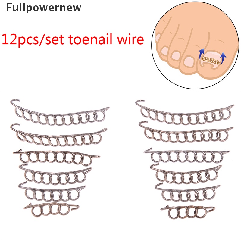 [FULL] 6pcs toenail correction tool ingrown wire fixer toe nail recover foot care