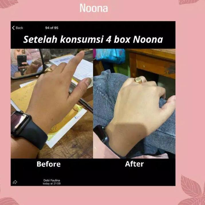 

Insta Sell⛄ AGEN RESMI Noona Collagen Drink BPOM & HALAL ( AMAN BUSUI ) Terbaru/Promo Hari Ini/【Promo Hari Ini】/Terbaik/『Terlaris』