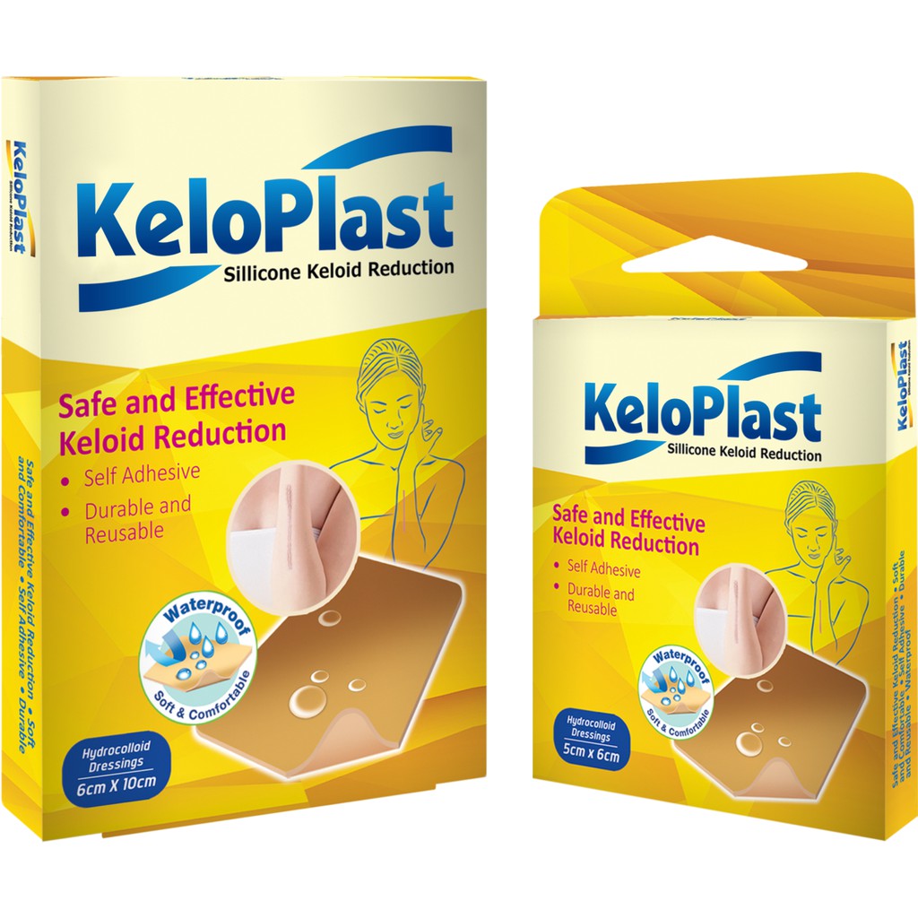 cylinder Leaflet Hornet Jual KeloPlast - Plester Anti Keloid Scar Bekas Luka | Shopee Indonesia