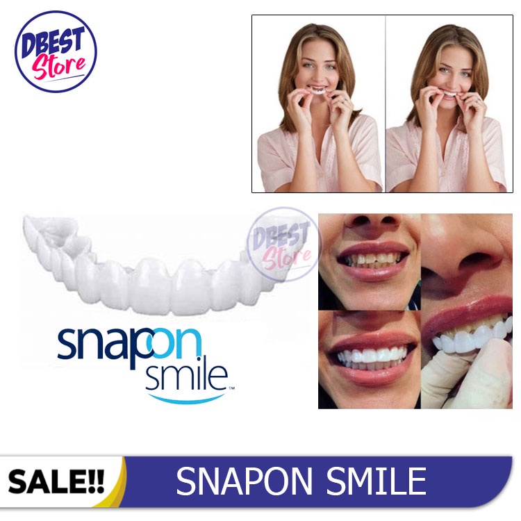 [ COD ] ORIGINAL 100% SNAP ON SMILE AUTHENTIC / GIGI PALSU SEPASANG ATAS BAWAH