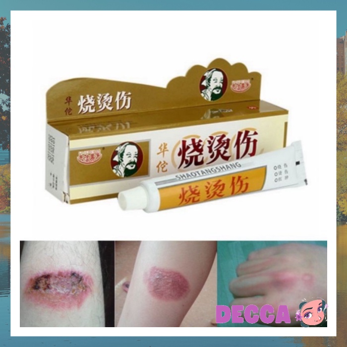 [BESTCHECK] SALEP SHAO TANG OBAT HERBAL LUKA BAKAR MELEPUH KELOID TRADISIONAL CINA