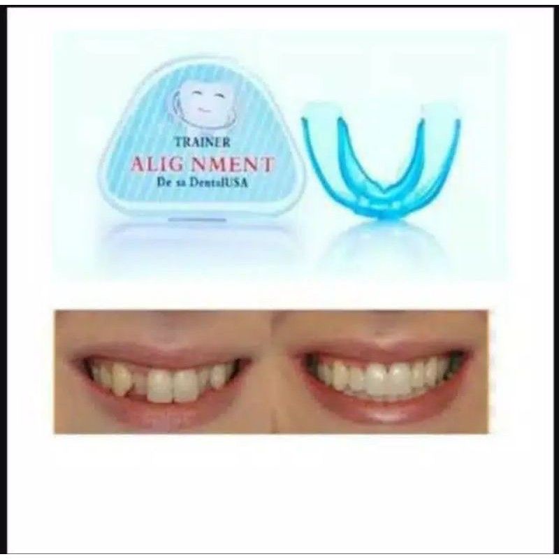 Bundara.id Pr-864 Teeth trainer allignment orthodontic Perapi gigi