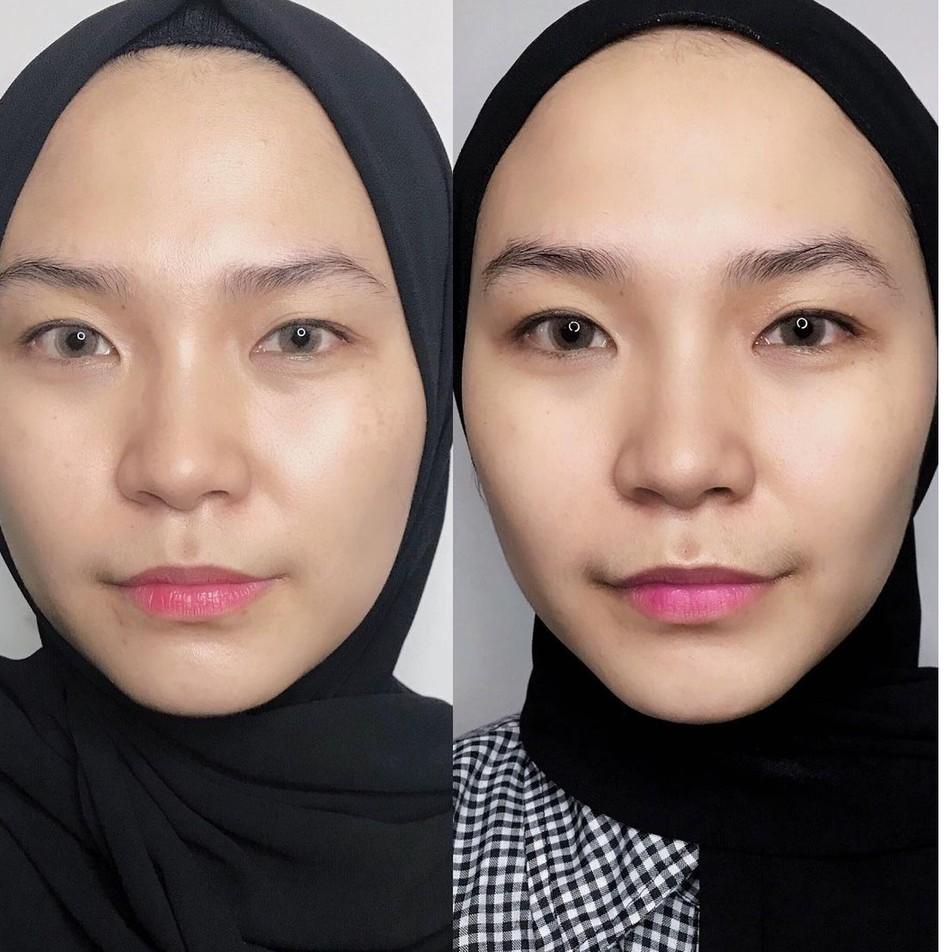 H-16 Marine Therapy Dark Spot Correcting Serum | ALWAYS BE PURE 437RSQ