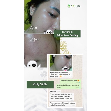 Paket Acne Dosting Colista skin Care-3
