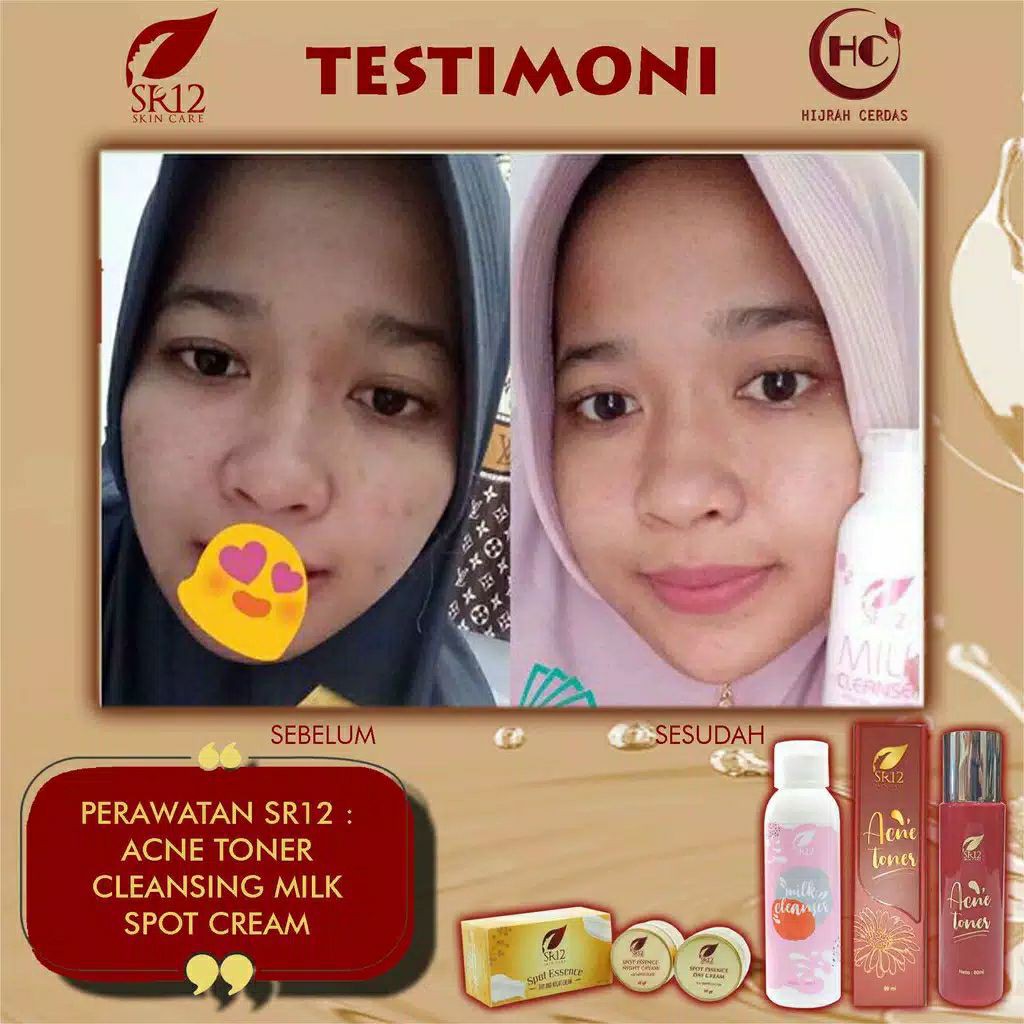 ACNE TONER SR12 / TONER JERAWAT BPOM / OBAT JERAWAT BERUNTUS / PENYEGAR KULIT WAJAH 60 ML