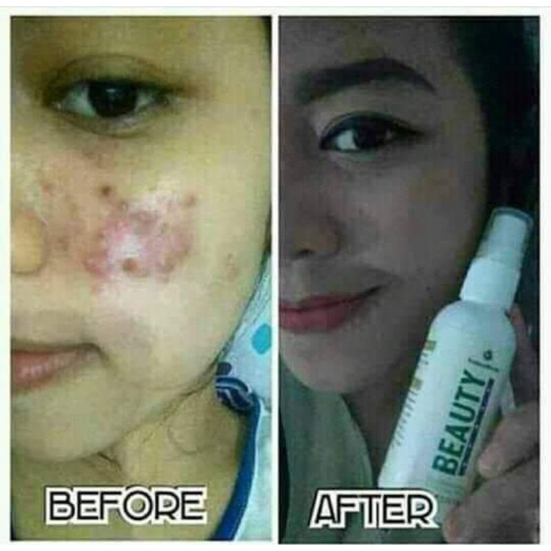 

Natura_Beuty_Spray_Ori