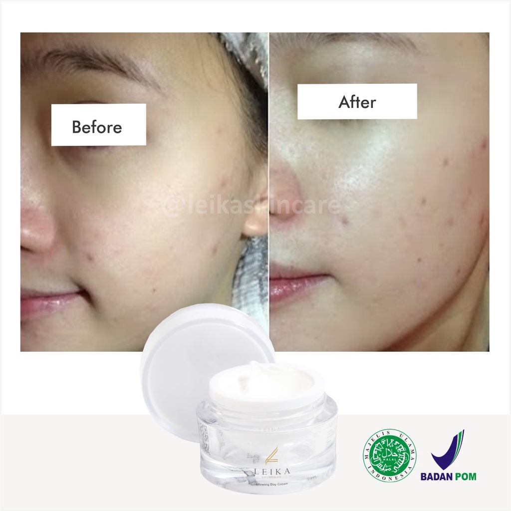 Menakjubkan! Krim Pelembab Wajah Kering dan Berminyak [Ampuh!] Cream Pelembab Wajah Jerawat jadi Glowing / Glowing Day Cream Leika Skincare 10gr Cream Pelembab Glowing Aman Ampuh Original BPOM Halal MUI