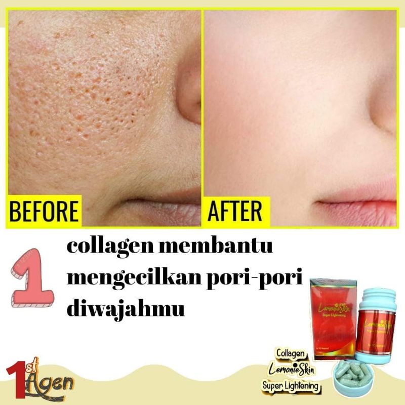 [ BISA COD ] TERMURAH ECER COLLAGEN C-LEMONIE D'LEMONIE DLEMONIE BPOM