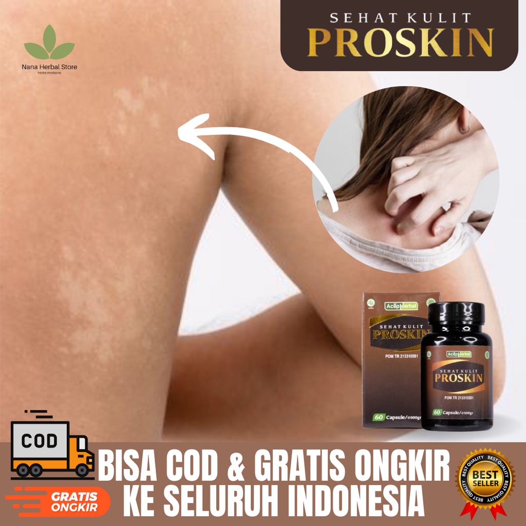 Obat Penghilang Panu, Obat Panu Hapur Di Wajah, Obat Jamur Kulit Membandel, Obat Panu Di Punggung Da