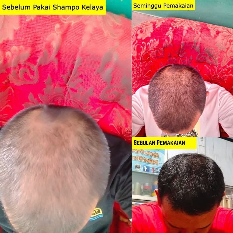 Shampo  Kelaya Penumbuh Rambut Anti Rontok 250ML