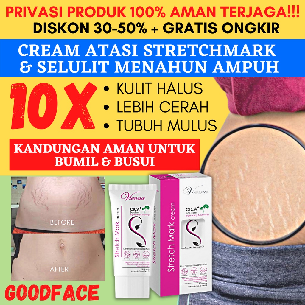 [PRIVASI] PENGHILANG STRECHMARK CREAM VIENNA STRETCH MARK PERAWATAN TUBUH