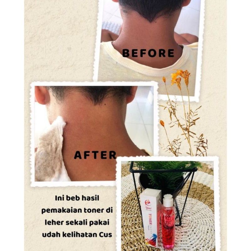 ‼️READY‼️TONER BADAN YONI SKINCARE BPOM/PENGHILANG DAKI