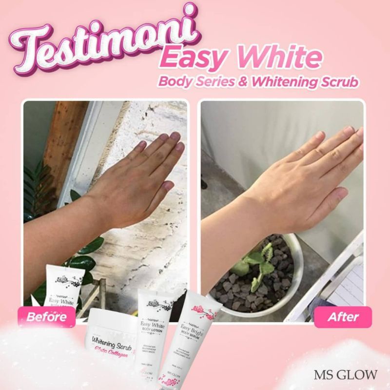 MS Glow Hand Body 100% original bisa cod