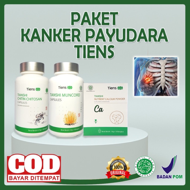 KISTA DAN KANKER PAYUDARA