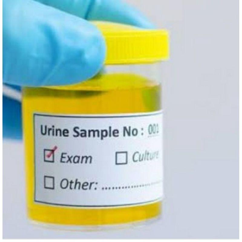 Sample urine ibu hamil 60ml Termurah