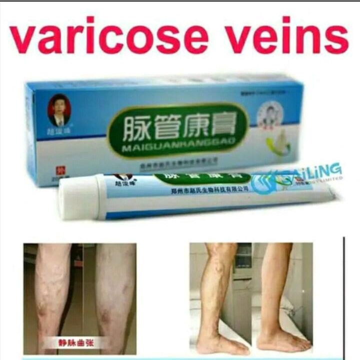 SHINE STAR - Obat Krim Penghilang Varises Maiguankanggao / Varicose Veins Treatment Cream Salep Cina Herbal Parises