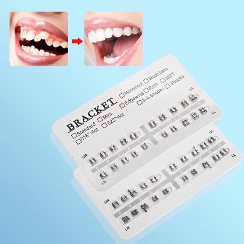 Bracket Ortho Behel Gigi Perawatan Hooks No Hooks Dental