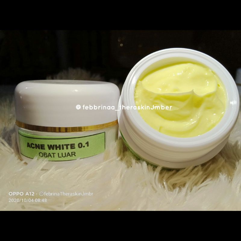 

acne white 0,1