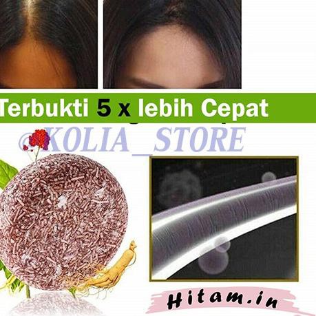 ✽ HITAMIN.ID SAMPO TREATMENT ATASI RAMBUT RONTOK KUSAM KETOMBE BERLEBIH KULIT KERING UBAN ORIGINAL ♂