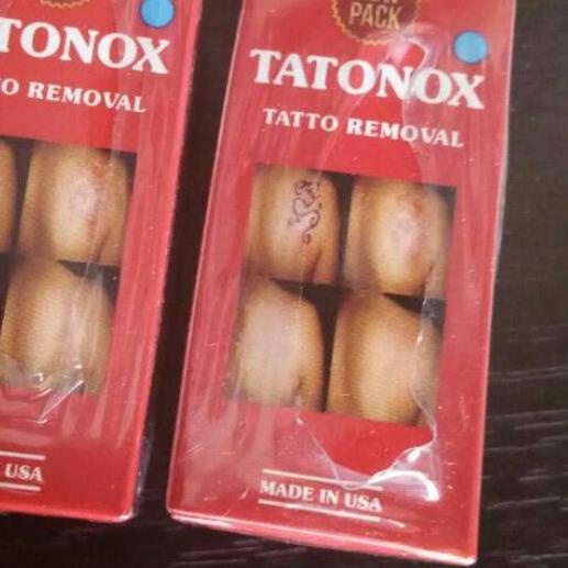 ✻ Tatonox Penghilang Tato ☪