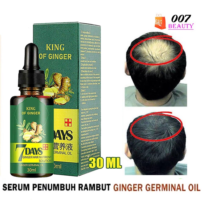 Jual Minyak Penumbuh Botak Rontok Dan Perawatan Rambut 30ml Clothes Of Skin 7 Days Korea Ginger 5716