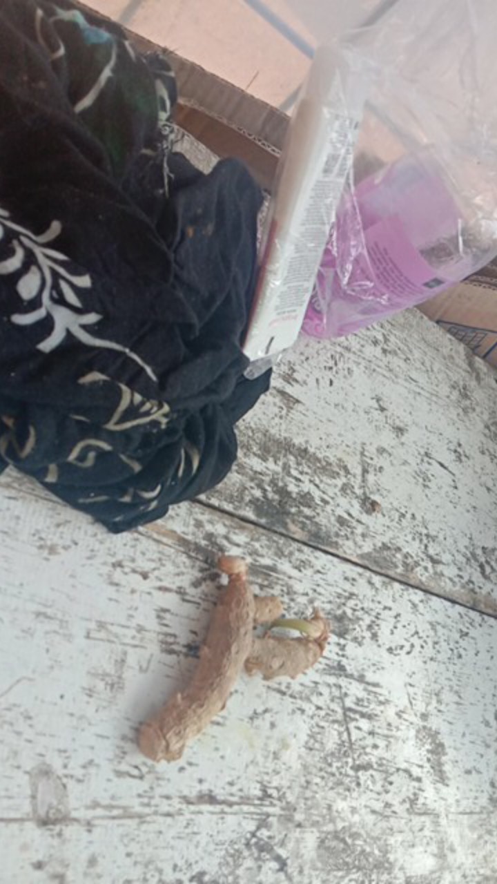 Face Shield Medis Apd Pelindung Wajah Kacamata Anti Fog