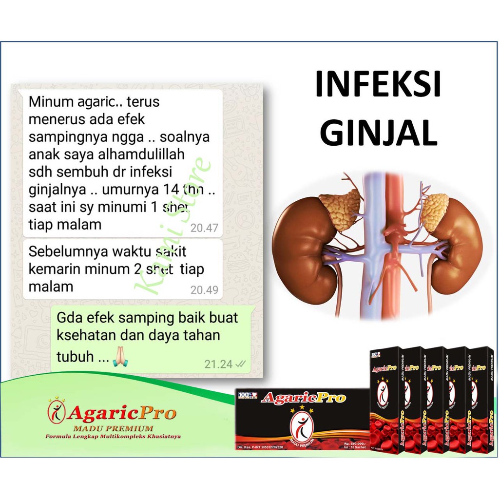 Obat Batu Ginjal Penghancur Batu Ginjal Gagal Ginjal Batu Empedu Kencing Batu Paling Ampuh Herbal Indonesia