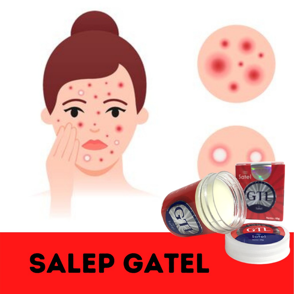 PROMO SALEP SATEL GTL, ORIGINAL ASLI 100% BPOM | SALEP SATEL GTL GATEL-1