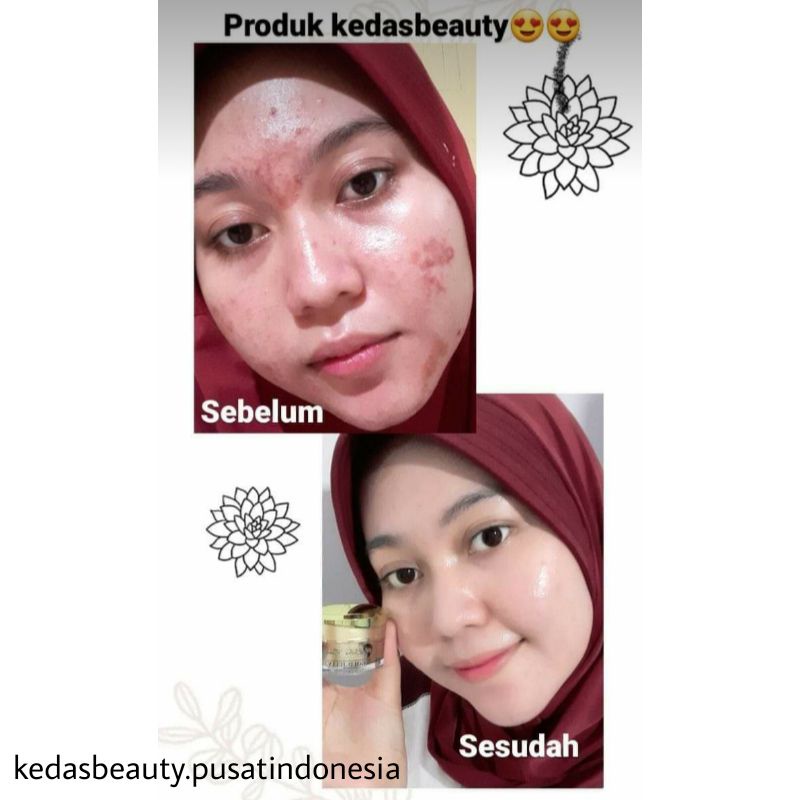 Sabun Kedas Beauty Original BPOM Sepaket Gold Jelly Kedas Beauty Pemutih Wajah Murah Cod-4