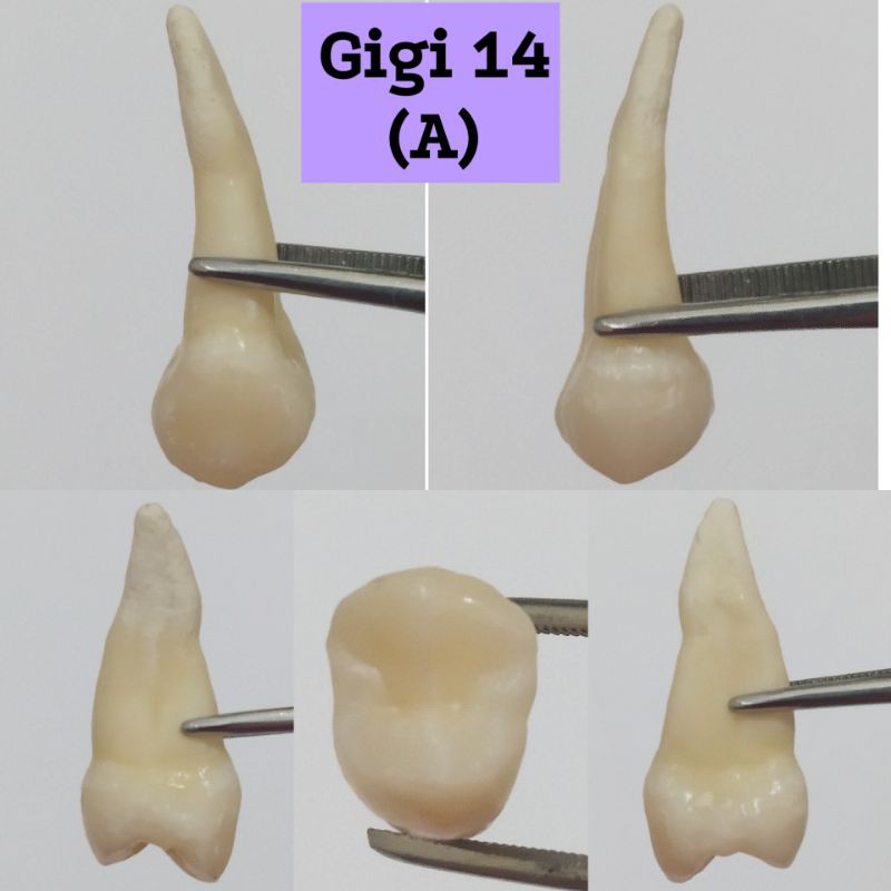 Gigi 14 / Gigi Premolar 1 Rahang Atas | Shopee Indonesia
