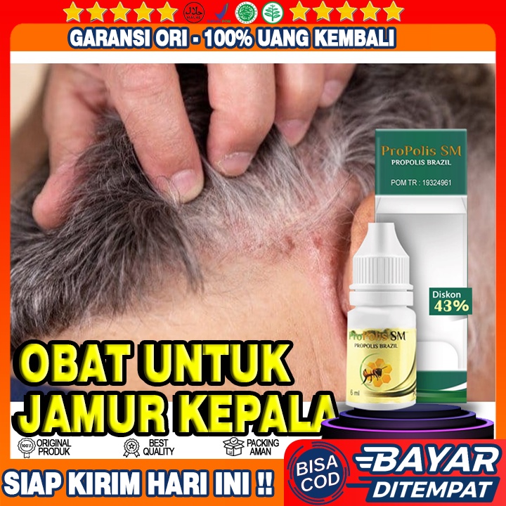 Obat Jamur Di Kepala Herbal Propolis SM, Obat Kulit Kepala Berjamur, Obat Kulit Kepala Borok