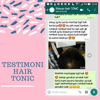 Hair Tonic Penumbuh Penyubur Rambut  Herbal  Obat Botak 