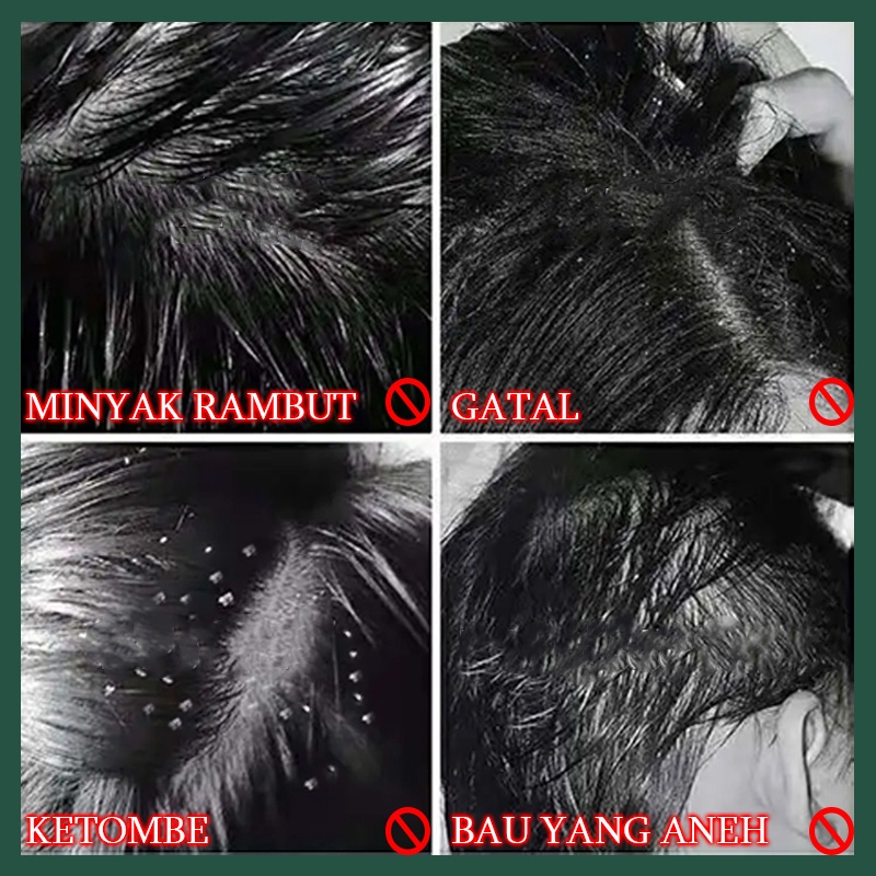 Anti-dandruff shampoo Sampo anti ketombe Shampo anti rontok Shampoo kutu rambut Sangat menutrisi rambut Mengurangi ujung bercabang Sterilisasi yang efisien dan anti ketombe