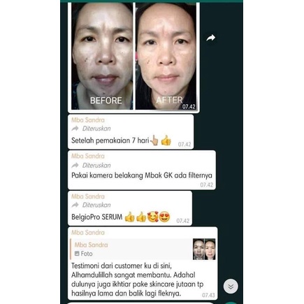 Belgie Pro Anti Aging Serum Serum Wajah Serum Anti Penuaan By Ippho Santosa Isi 10ml