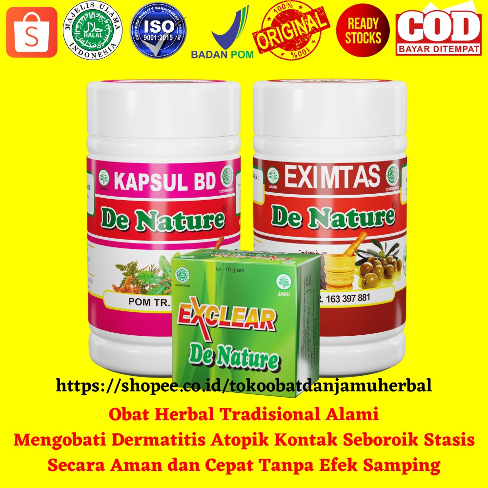 Obat Herbal Alami Mengobati Dermatitis Atopik Kontak Seboroik Stasis