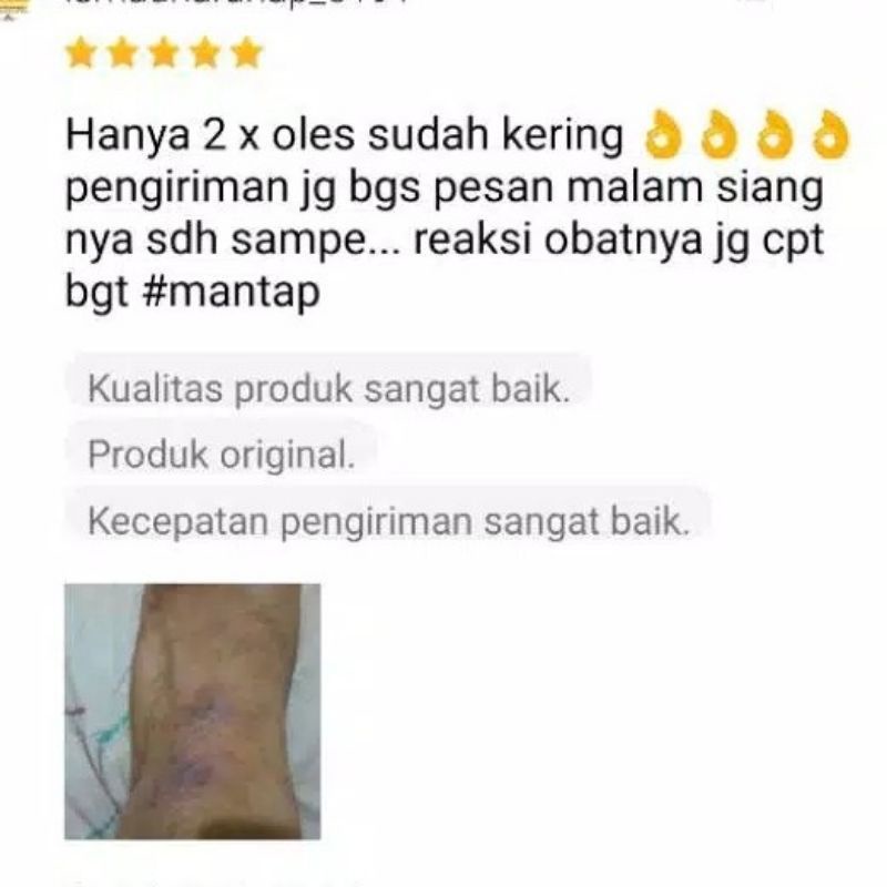 saleb bl original 100% asli salep gatal gatel selangkangan eksim exim kering paling manjur-8
