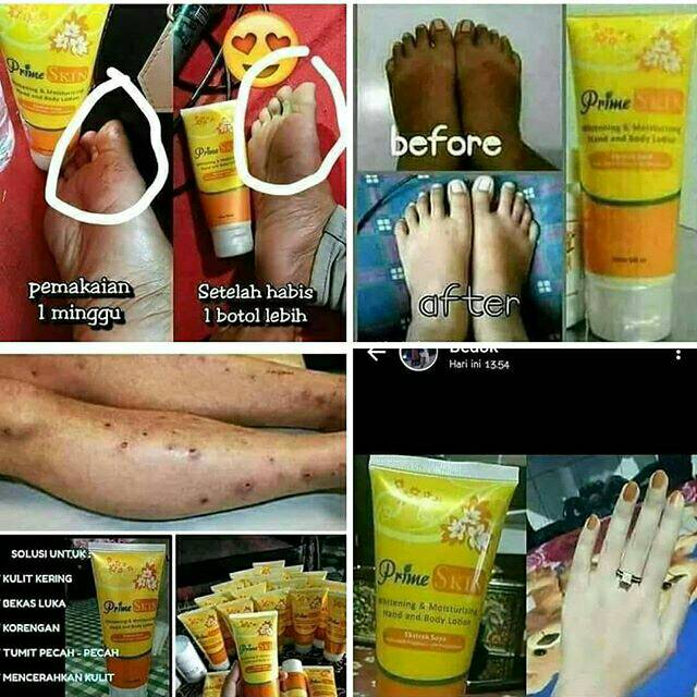 Menghilangkan korengan